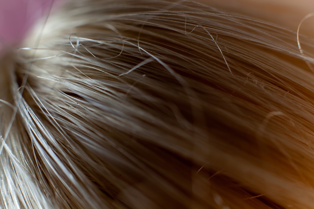 dandruff care
